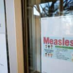 Measles cases linked to the outbreak in Texas reach 309, exceeding the national total in 2024