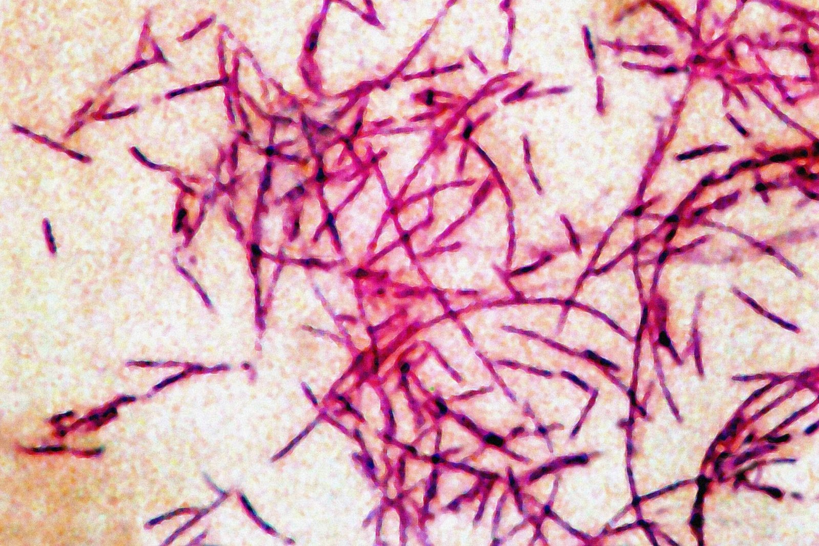 PHOTO: In this file photograph you can see the Legionnaires' disease bacteria.